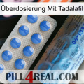 Überdosierung Mit Tadalafil 40